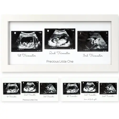 KeaBabies Wooden Picture Frame 3-Pack - Wood & Glass Baby Sonogram Frames, Gender Reveal Party Decor, First-Time Mom Gift, Wall/Shelf/Desk Desk-to-Wall Display, Newborn Nursery Decoration