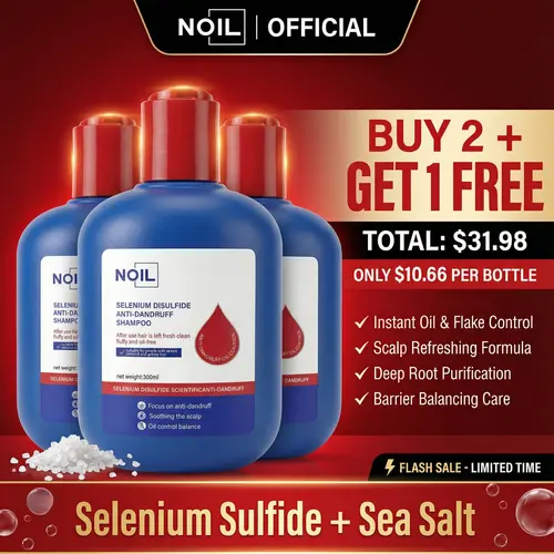 NOIL Selenium Disulfide Shampoo Oil Control Refreshing Anti-Dandruff Anti-Itch 300ML x 3 Bottles Buy 2 Get 1 Free Free Shipping
