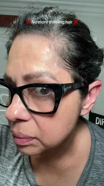 If you have thinning hair, this is what helped me! No more frizzy hair! No more dry hair! Just full, shiny, healthy hair for me. If you’re in menopaue like me, try this ❤️ #TTS #TikTokShopUSA #TikTokShopMadeMeBuyIt #thinninghair #menopause #tiktokshopsummersale 