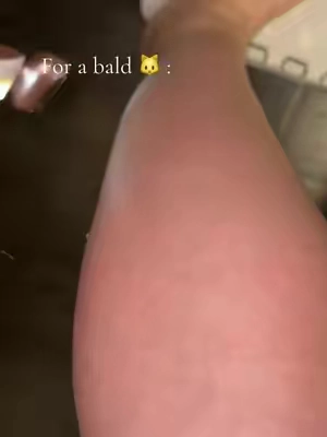 #viral 