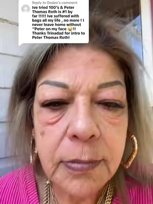 Replying to @Dedee @Peter Thomas Roth Labs #peterthomasrothinstantfirmeye #peterthomasrothofficial ##undereyebags #matureskin #skintok#blackfridaydeals INDIVIDUAL RESULTS MAY VARY 