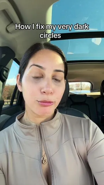 How I fix my eye dark circles quickly & without make up #darkcirclesundereyes #darkcircles #undereyedarkcircles #eyebrightener 