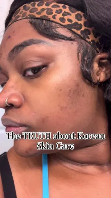 BELIEVE THE HYPE‼️Korean Skin Care Products is changing the game. @Medicube US has changed my skin COMPLETELY‼️ Acne prone skin Korean skin care recommendation #medicube #koreanskincare #tiktokblackfriday #holidayhaul #tiktokcybermonday #glassskin #giftguide 