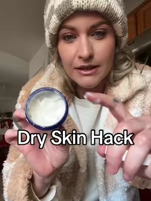The best hand cream I have found yet!!! And if you suffer with psoriasis or eczema, you have to try this! 
@Healed By The Ocean 

#eczema #psoriasis #dryskincare #dryskintips #skincare #handcream 