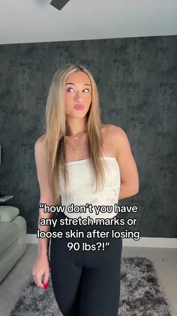 This product WORKS WONDERS to fade stretch marks and loose skin😩 #weightloss #stretchmarks #fatloss #fitness #fyp #foryoupage #relatable #tiktokshop #weightlossprogress #bflat #relatable #motivation #gymtok #gym #musthaves 