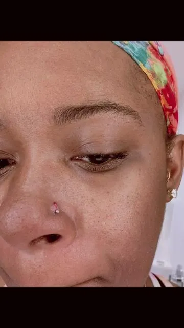 Piercing Bump Remover ✨ #piercings #piercingbump #tiktokshop 