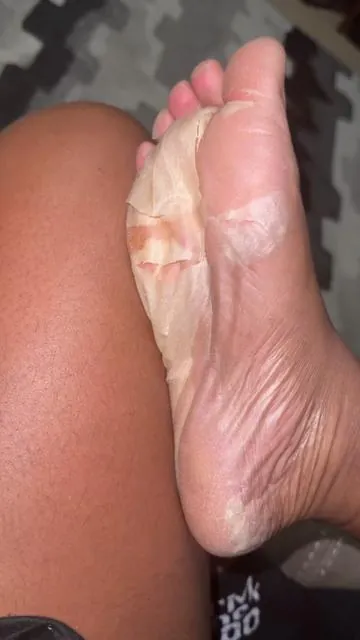 I know it's kinda gross but l had to show yall how this foot peel mask works!  Sandal season is approaching, make sure your feet are nice and soft 😌  SN: My feet HAS to touch my husband in bed lol he’s just talking all that mess in this video 😏 #footpeelingmask #footpeel #fype #foryou #womenshealth #hygiene #softskin #peeloffmask #FootPeel #Callous #CallusRemoval #DryFeet #DrySkin #CrackingFeet #Peeling #footcare #beauty #footmask #peach #aloevera #allnatural #natural #skin #tiktokshoprestock #tiktokshopspringglowup #ttslevelup #creatorboostcamp 