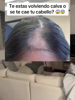 Te estas volviendo calva o estás perdiendo mucho cabello? #fyp #parati #latinos #mexicanos #hispanos #latinas #cabello #cabellosaludable #cabellolargo #cabellosano #caidadecabello #hairloss #womenshair #healthyhairjourney #healthyhairtips #hairgrowth #strongerfullerhair #womenshaircare #hairlosssolutions #hairlossremedy #naturalsant #naturalsantusa 