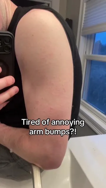Get rid of them before summer! 