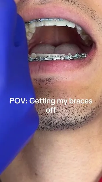 How to get your teeth white😁@GuruNanda LLC @Puneet Nanda bridge the gap  #GuruNanda#routine #grwmroutine#teethwhitening #braces #bracestips #bracesoff #fyp #viral #food #candy #bracescolors #transformation #sour 