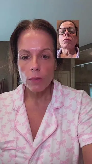 This is pretty much my full list of products I am using or have used to get my neck so much better than where I started. You don’t have to believe me or my journey and you don’t have to try any of the products. I am just providing what helped me.  #NecksphaltRoutine #NeckTighteningJourney #SnatchedNeckGoals #TikTokSkincareFinds #ViralNeckHack #NeckCareEssentials #LEDLightTherapy #MicroneedlingResults #NeckMaskGlow #TikTokMadeMeBuyIt #ShopNow #GlowUpRoutine @dr.melaxin_official 