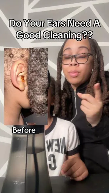 I give this a 10/10!! Don’t walk, RUN and put this in your cart NOW!! #earcleaning #healthtips #earwaxremoval #asmr #foryou #earwax #ears #earclean #earcare #tiktokmademebuyit 