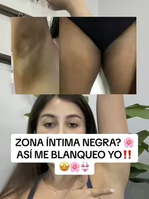 Con ácido glicolico y láctic‼️ADIÓS A ESAS ZONAS NEGRAAAASSSS🥳🥳 #trulybeauty
#truly #smellgood #women #moisturizer#aftershave #hidratacion #bodyoil
#zonaintima #intimacy #SelfCare #care #moisturizer #moisturizing 