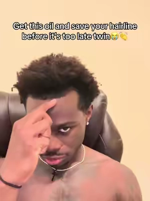 Im barely 21 im not going bald bro F that🤣 #thinninghair #thinninghairsolution #balding #rosemaryoil 