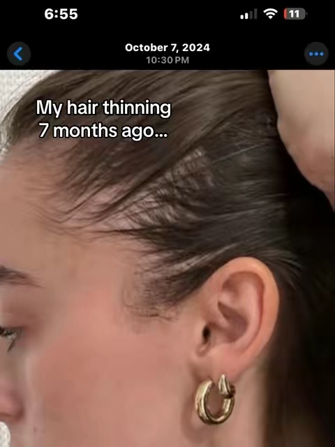 My hair growth journey!!#fyp #maryruthsorganics #maryruths #hairgrowthtips #hairgrowth 