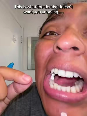 Now you know… 🤯 #teethtok #teethcare #teethtok #cavities #sensitiveteeth 