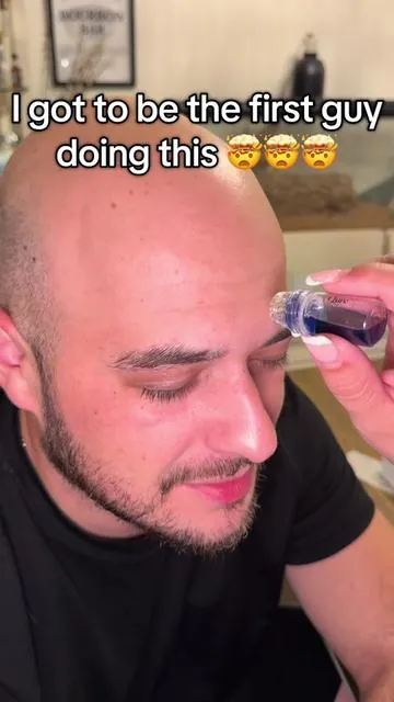 If you haven’t tried micro needling, I recommend everybody trying this. This is honestly the craziest thing I have ever witnessed in my life. #MicroNeedling #microneedlingtherapy 
