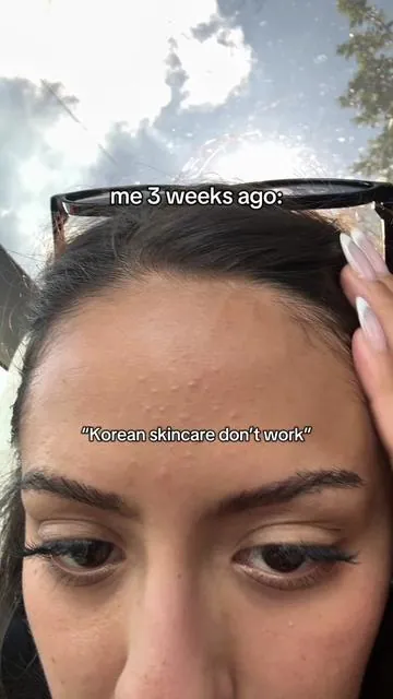 Def get it now while its on sale usually its $225 😭 #koreanskincare #glassskin #acne #GlowUp #kbeauty  