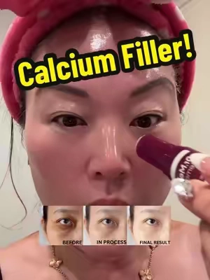 Dr. Melaxin Calcium Volume Filler!  #spotlightfinds #tiktokshopcreatorpicks #Rushtok2025 #spotlightfinds  #ttslevelup  @Dr.Melaxin Global 