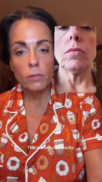 This is the neck tightening routine I have been using for months that I swear by for improvement if loose skin and crepey lacy skin. #DrMelaxinNecksphalt   #NeckCareRoutine   #AntiAgingNeckHack   #SmoothNeckGlow   #TikTokSkincareFind @Dr.Melaxin Global 