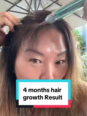 Wow, this is the best hair ampoule ever! #spotlightfinds #tiktokshopcreatorpicks #Rushtok2025 #spotlightfinds  #ttslevelup  @VT Cosmetics US 