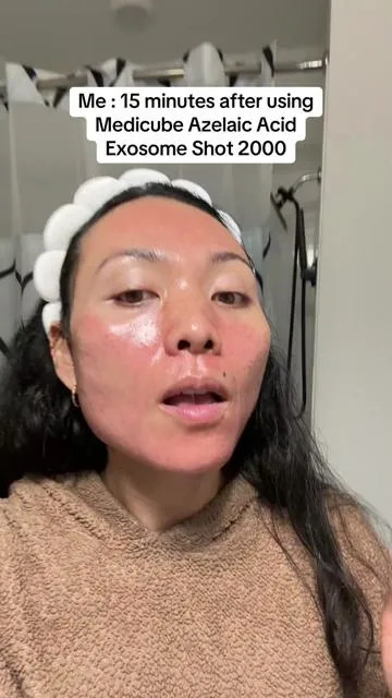 New drop~ Medicube Azelaic Acid Exosome Shot 2000/7500 for sensitive & acne prone skin 💕 @medicube US Store #medicube #medicubeazelaicacidexsomeshot #acneproneskin #tiktokshopcreatorpicks #tiktokshopseptemberrestock 