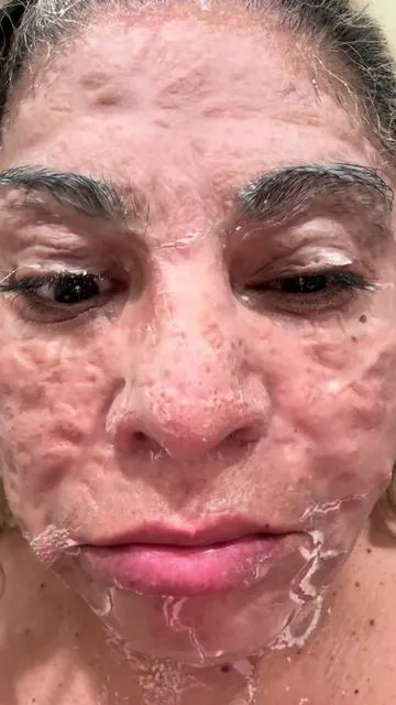 #makerose #antiaging #venom #firming #skincare 