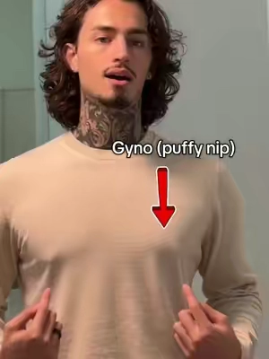 This needs to be talked about… 😅 #ekkovision 