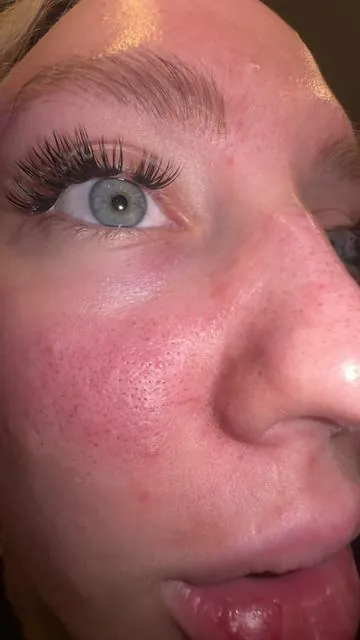 add this to your skincare rotation NEOWWW @Drmelaxin #drmelaxin #drmelaxinpeelshot #peelshot #exfoliate #exfoliation 