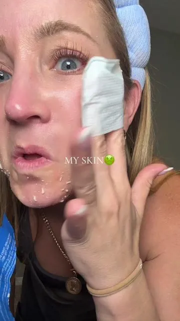 Exfoliator pads of my dreams and nightmares 😂😳 #skinexfoliating #exfoliation #skincareroutine #tiktokshopfalldealsforyou #tiktokshopblackfriday 