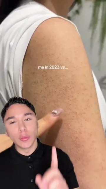 @celimax.global @celimax US Store #celimax #carlosantoniocerv #koreanskincare #keratosispilaris #cuidadodelapiel 