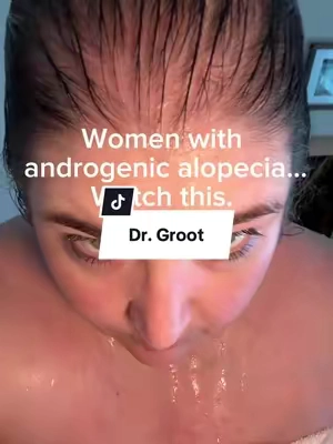 Women that are experiencing hairloss, I feel you.  @Dr. Groot Hair #androgenicalopecia #tiktokshopcybermonday #tiktokshopblackfriday #hairlosssolutions #scalpcare 