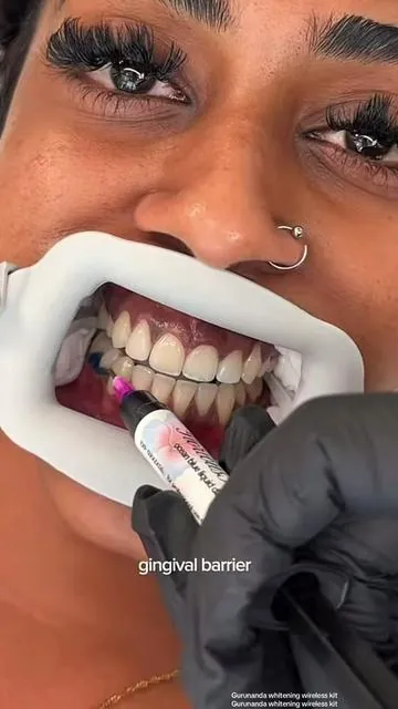 #gurunanda #teethwhitening #gurunandawirelesswhitening #whiteteeth #tiktokshopcybermonday @GuruNanda LLC @Puneet Nanda bridge the gap 