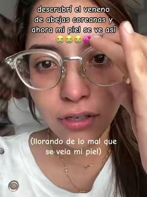 nunca mas la dejo de usar 🥹 #pielbonita #acne #parati #pielsana #skincare 