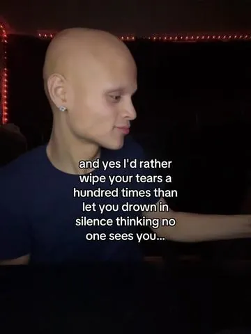 10 out of 10!!#alopecia #gxbrielpn #godisgood 