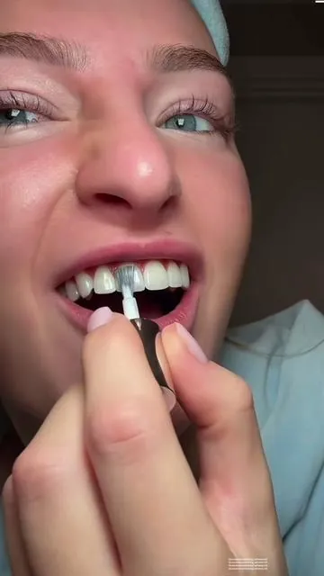 #gurunanda #teethwhitening #gurunandawirelesswhitening #whiteteeth #tiktokshopholidayhaul @GuruNanda LLC @Puneet Nanda bridge the gap  Video credit: @Elma Rebecca 