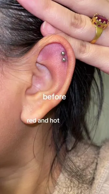 i promise it’s the same ear i used the front camera for the after 😭 #piercing #piercingaftercare 