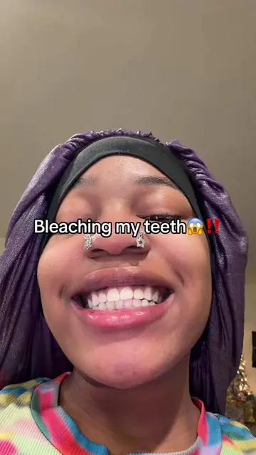 #hismile #teethwhitening #fyp #oralhealth 