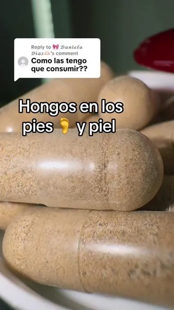 Replying to @🎀 𝓓𝓪𝓷𝓲𝓮𝓵𝓪 𝓓𝓲𝓪𝔃🫶🏻 Tackle Toenail Fungus Naturall #hongos #hongosenlasuñas #hongosenlospies #hongos 