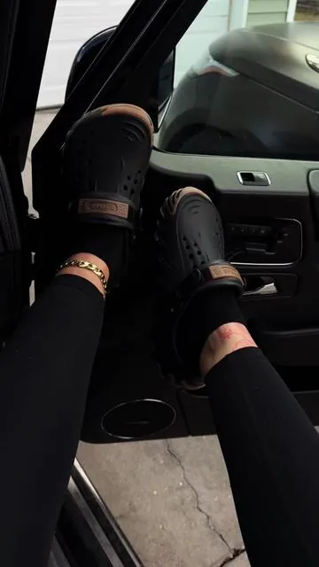 #crocs #crocsechoro #crocsecho 
