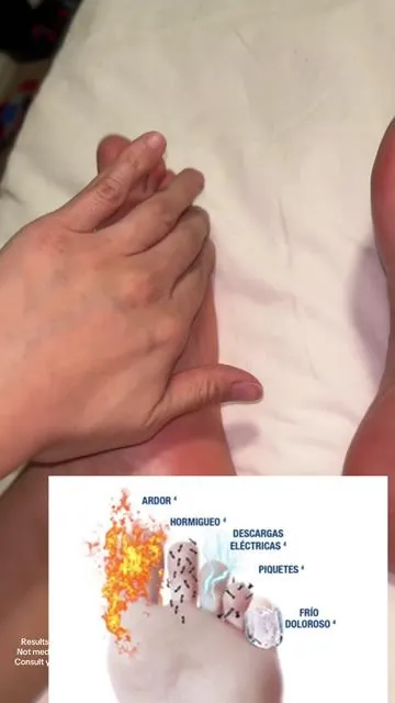 #neuropatia 