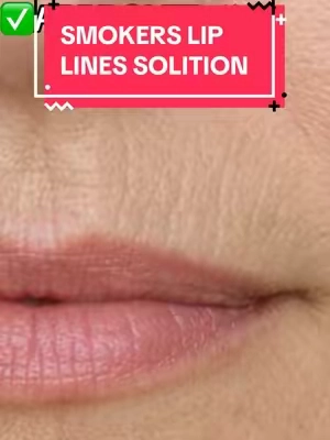 Smoker lip lines are very stubborn and hard to treat. Here is the best thing I have found so far. Dr Melaxin Volume Balm #tiktokshopjumpstartsale #tiktokshopcreatorpicks #antiagingskincareroutine #koreanskincare 