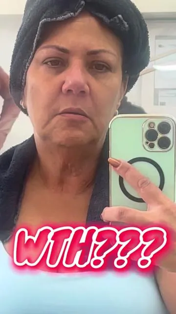 57 & my skin hasn’t looked this even in YEARS. Medicube PDRN Pink Collagen + Exosome Shot 7500 is that girl. One month. Real results. Mature skin approved. #Medicube #PDRN #MatureSkin #Over50Beauty #SkinRegen