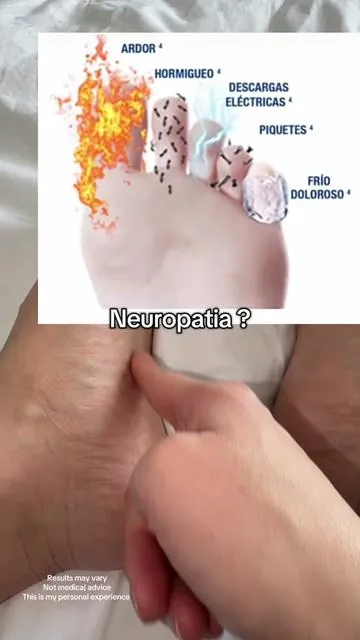 #neuropatia 