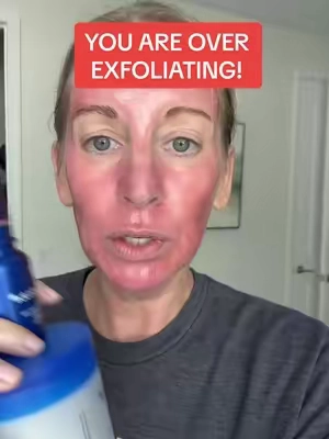If you are using the Medicube Zero Pore Pads more than two times per week or the Medicube One Day Exosome Shot more than one time per week. You are wrecking your skin.  ##exfoliation##tiktokshopcreatorpicks