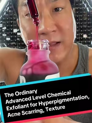 Advanced Level Chemical Exfoliant. 30% AHA 2% BHA. The Ordinary AHA 30% + BHA 2% Peeling Solution is an advanced-level chemical exfoliant that works by dissolving the "glue" that holds dead skin cells together on the surface and inside the pores. It is highly effective for improving skin radiance, refining texture, and clearing pore congestion, but it is formulated only for experienced users of acid exfoliation due to its high acid concentration.  The Ordinary The Ordinary  +2 How the Peeling Solution Works The formula combines two main types of hydroxy acids that target different layers of the skin: Alpha Hydroxy Acids (AHAs) - 30%: A blend of glycolic, lactic, tartaric, and citric acids that exfoliate the skin's topmost surface. By removing these superficial layers, it helps fade sun damage, smooth uneven texture, and reduce the appearance of fine lines. Beta Hydroxy Acid (BHA) - 2%: Specifically salicylic acid, which is oil-soluble. Unlike AHAs, BHAs can penetrate into the pores to dissolve sebum and debris, effectively reducing congestion that leads to blemishes, blackheads, and whiteheads.  Key Supporting Ingredients To balance the high acidity (pH ~3.6), the formula includes soothing and hydrating agents: Tasmanian Pepperberry: A plant-derived extract that helps reduce the irritation and redness often associated with strong acid use. Hyaluronic Acid Crosspolymer: Provides a comfortable skin feel and post-exfoliation hydration. Vitamin B5: Supports skin healing and enhances surface hydration. Black Carrot: Acts as an antioxidant for additional skin protection.  The Ordinary The Ordinary  +2 Effectiveness and Results User reviews and editorial tests consistently rate the product highly, often averaging 4.7 out of 5 stars.  Immediate Impact: Users frequently report "baby butt smooth" skin and a notable increase in radiance immediately after the first 10-minute treatment. Texture and Tone: With continued use (ideally once a week), it effectively "blitzes" small spots, flattens whiteheads, and refines the appearance of pores. Professional-Grade at Home: It is considered one of the closest at-home alternatives to a professional dermatologist's peel due to its 32% total acid concentration.  Reddit Reddit  +3 Essential Safety Guidelines Because of its potency, this product must be used with extreme caution: Usage Limits: Use only in the evening, no more than twice a week. Time Limit: Never leave it on for longer than 10 minutes. Application: Apply only to thoroughly dry, clean skin. Do not use on broken, sensitive, or peeling skin. Sun Sensitivity: AHAs significantly increase sun sensitivity; daily sunscreen use is mandatory during use and for one week after stopping. Incompatibilities: Do not use in the same routine as other direct acids, retinoids (Vitamin A), or Vitamin C #beauty #skincare #koreanskincare #face #hyperpigmentation 
