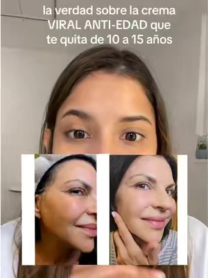 Replying to @Soy Nora💚 TTS ES VERDAD LOS TONICOS DE ARROZ ACELERAN TODO 🤫💕 #GlowUp #antiedad #skincare #blanquearlapiel #aclararlapiel 