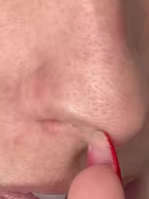 If your nose looks like a strawberry, don’t just extract, this 3 step blackhead system also includes the cactox elixir for pore tightening and relief 
