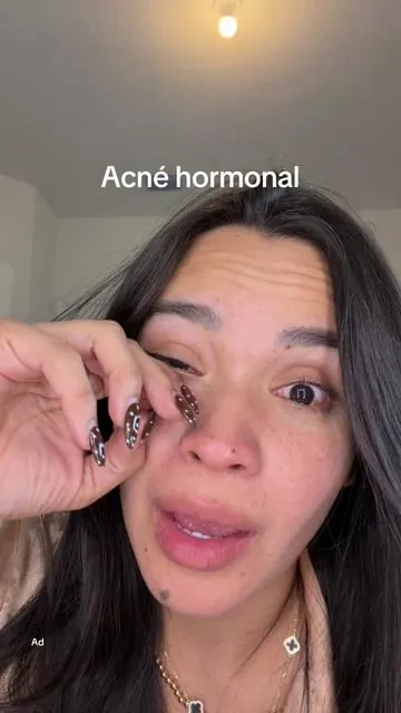 Éste es uno de mis favoritos porque lo uso una noche antes y en la mañana amanezco feliz con mi piel #acne #acnehormonal #skincare #drleo #hiperpigmentacion  Los resultados pueden variar @drleo_oficial 
