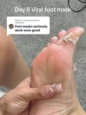 Replying to @maycewcarter @Plantifique #footpeel